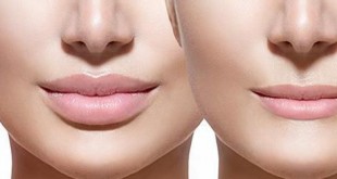 Збільшити губи можна і без застосування пластичної хірургії. Як збільшити губи в домашніх умовах - знає Енциклопедія Краси.Як збільшити губи в домашніх умов