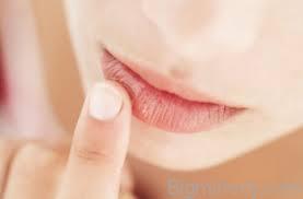 Чому тріскаються куточки губ і як їх лікувати