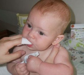 Наліт на язику у немовляти білого кольору як прибрати 1