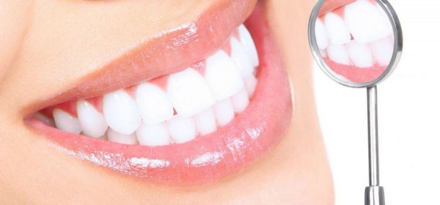 Як відбілити зуби – підбірка найкращих способів 